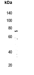 Beta-NaCH (phospho-Thr615)