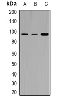 TYRO3/MERTK (phospho-Tyr749/681)