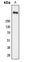 Ryanodine Receptor 2 (phospho-Ser2808)