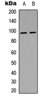 Insulin Receptor (phospho-Tyr1361)