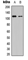 PRKD1/2/3 (phospho-Ser738/Ser742)