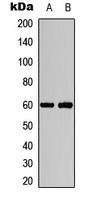 AKT1/2 (phospho-Thr308/309)