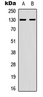 EPHA2 (phospho-Tyr588/596)