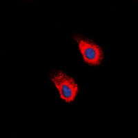 Rabbit Polyclonal Antibody to EPHA2 (phospho-Tyr588/596)
