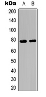 Ezrin/Radixin/Moesin (phospho-Thr567/564/558)