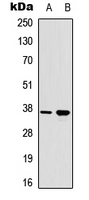 RAD51A (phospho-Tyr315)