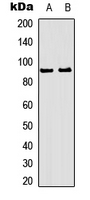 RSK1/2/3 (phospho-Thr573/570/577)