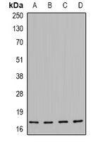 HSP2(phospho-Ser16)