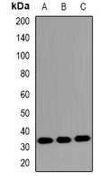 MKI67IP (phospho-Thr234)