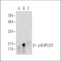 4E-BP1/2/3 (Phospho-Thr 45)