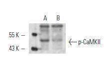 CaMKII (Phospho-Thr 286)