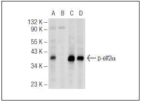 eIF-2a (Phospho-Ser 52)