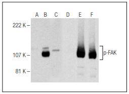 FAK (Phospho-Ser 722)