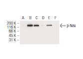 HER2 / ErbB2 (Phospho-Thr 686)