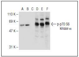 p7S6 Kinase (Phospho-Ser 411)