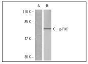 PKR (Phospho-Thr446)