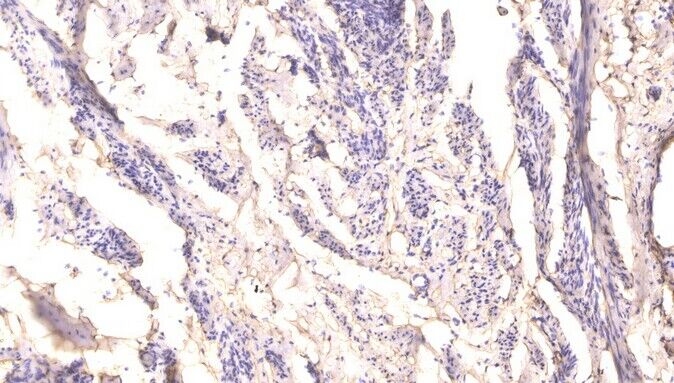 RIP (phospho-Ser166)  rabbit pAb