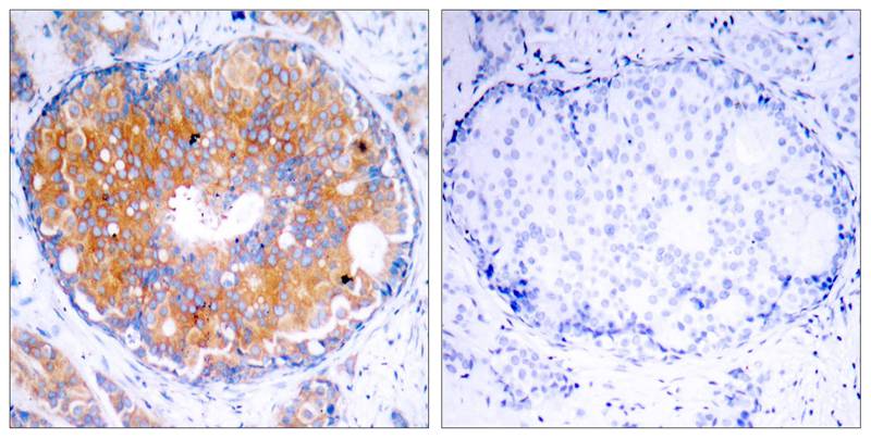 Rabbit Polyclonal Antibody to MEK2(Ab-394)