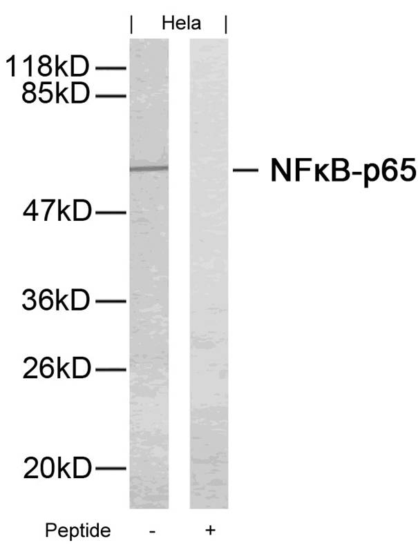 NFkB-p65(Ab-276)