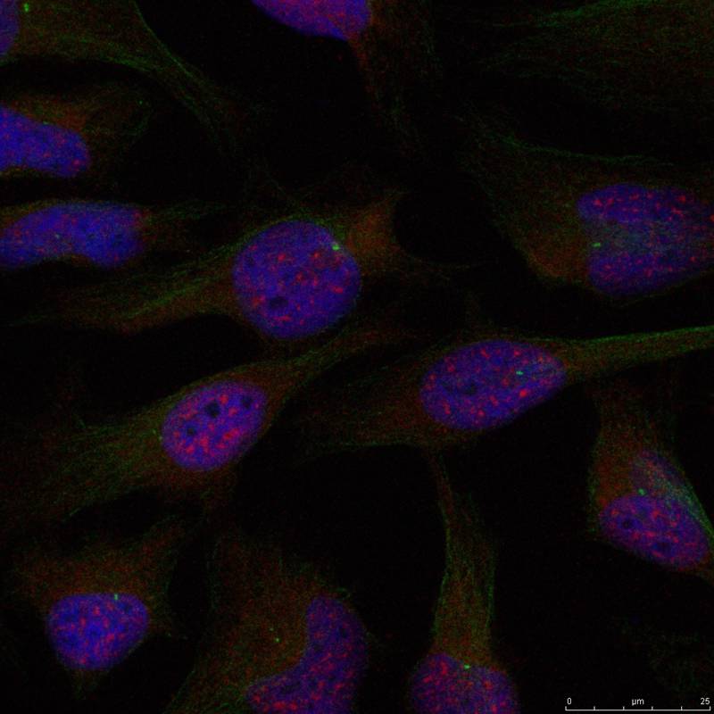 Rabbit Polyclonal Antibody to NFkB-p65(Ab-276)