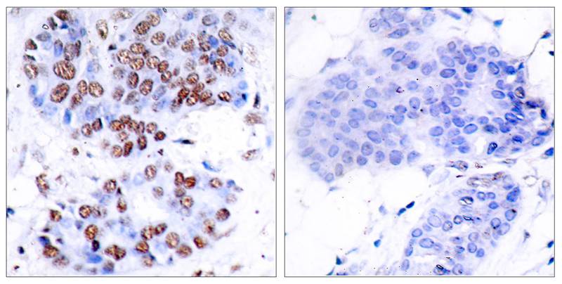 Rabbit Polyclonal Antibody to NFkB-p65(Ab-276)