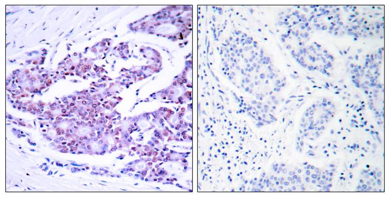 Rabbit Polyclonal Antibody to NFkB-p65(Ab-468)