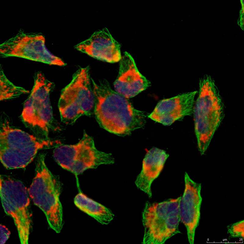 Rabbit Polyclonal Antibody to NFkB-p100(Ab-866)