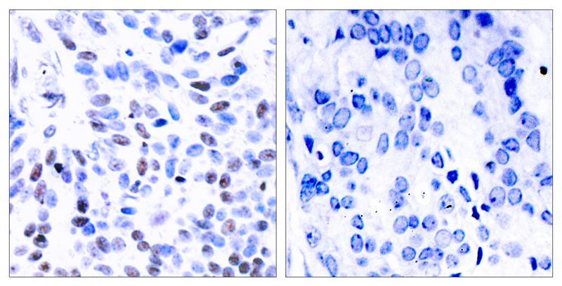 Rabbit Polyclonal Antibody to NFkB-p100(Ab-866)