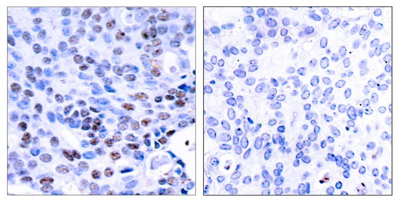 Rabbit Polyclonal Antibody to NFkB-p105/p50(Ab-337)