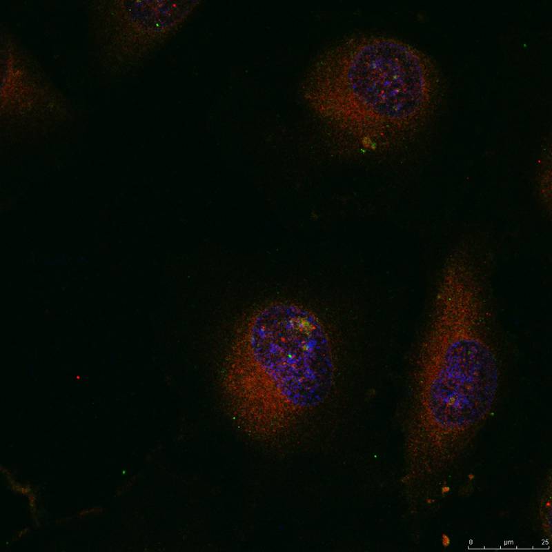 Rabbit Polyclonal Antibody to c-Jun(Ab-91)