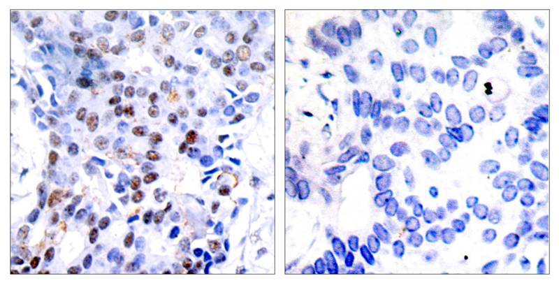 Rabbit Polyclonal Antibody to c-Jun(Ab-91)