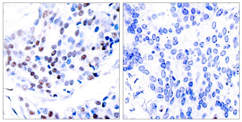 Rabbit Polyclonal Antibody to c-Jun(Ab-239)