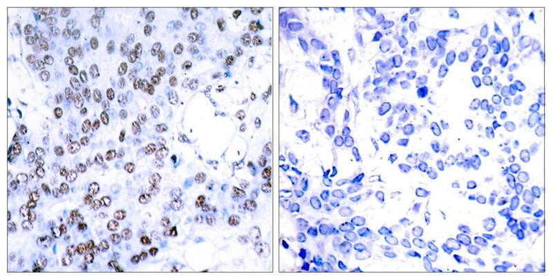 Rabbit Polyclonal Antibody to JunB(Ab-79)