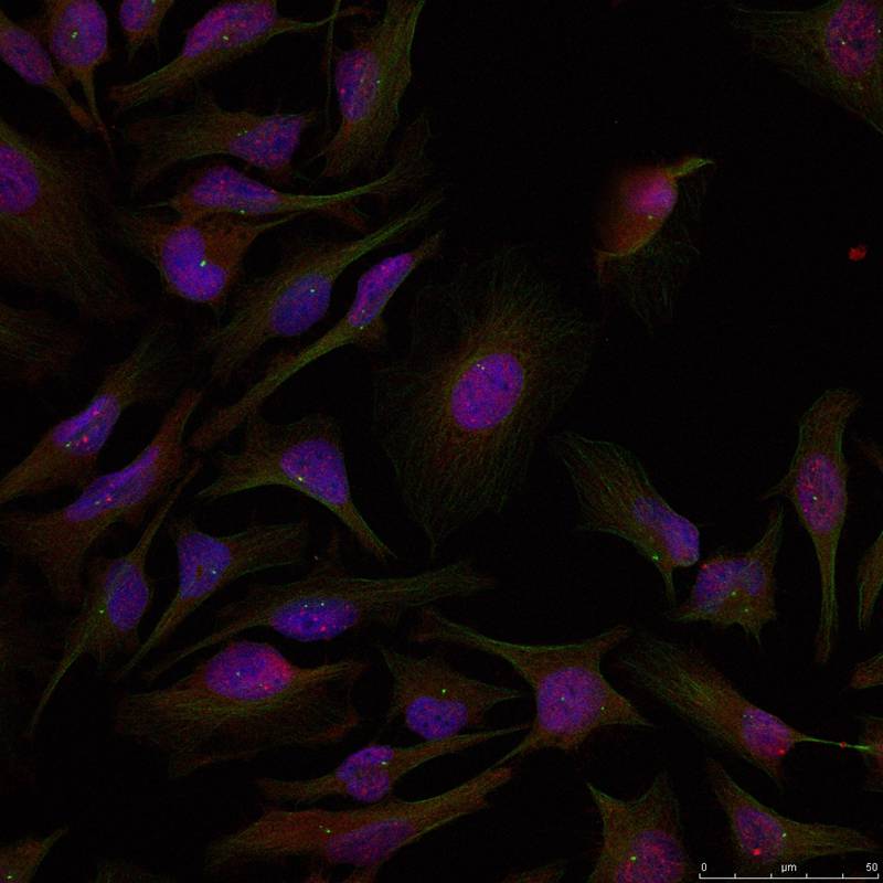 Rabbit Polyclonal Antibody to ATF2(Ab-71 or 53)