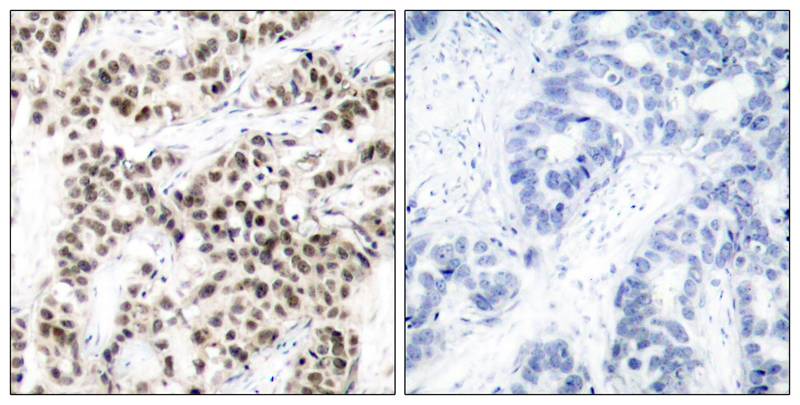 Rabbit Polyclonal Antibody to Myc(Ab-58)