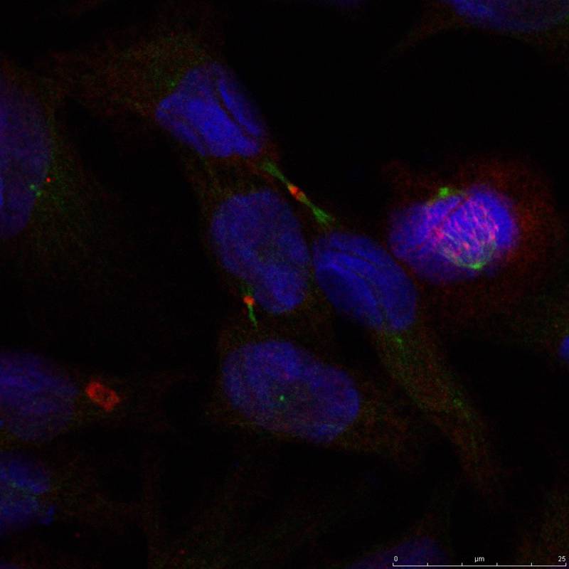 Rabbit Polyclonal Antibody to Elk1(Ab-389)