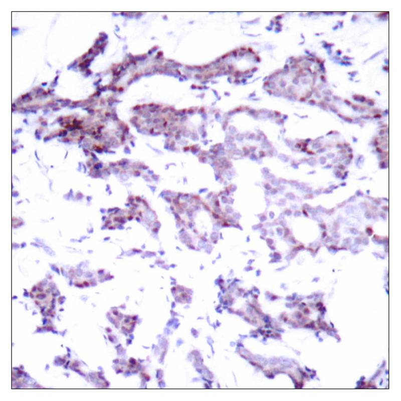 Rabbit Polyclonal Antibody to Elk1(Ab-389)