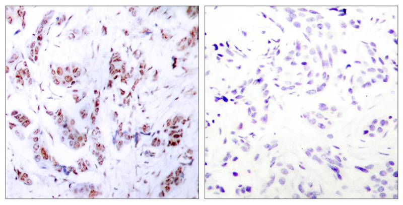 Rabbit Polyclonal Antibody to MEF2a(Ab-312)