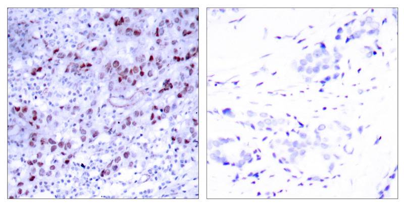 Rabbit Polyclonal Antibody to GATA1(Ab-142)