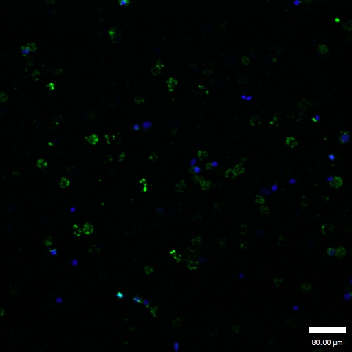 Rabbit Polyclonal Antibody to GATA1(Ab-310)