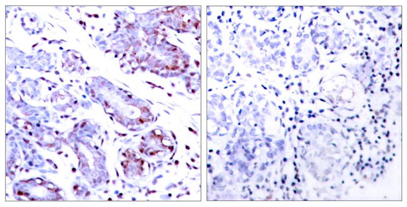 Rabbit Polyclonal Antibody to STAT1(Ab-701)