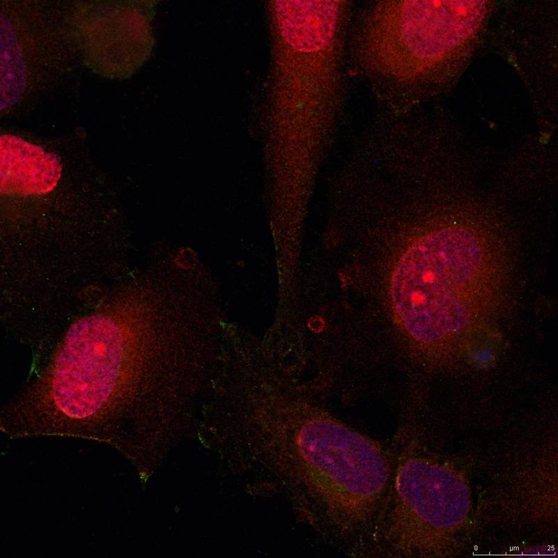 Rabbit Polyclonal Antibody to STAT3(Ab-705)