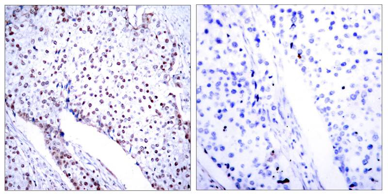 Rabbit Polyclonal Antibody to STAT3(Ab-705)
