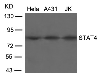STAT4(Ab-693)