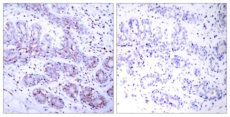 Rabbit Polyclonal Antibody to STAT4(Ab-693)