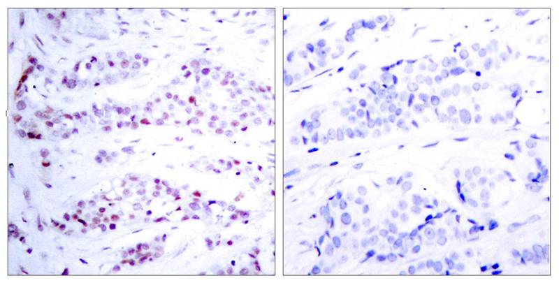 Rabbit Polyclonal Antibody to STAT6(Ab-641)