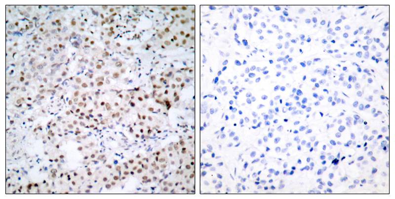 Rabbit Polyclonal Antibody to CREB(Ab-133)