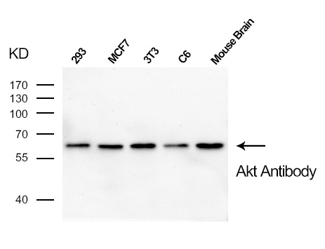 Rabbit Polyclonal Antibody to Akt(Ab-473)