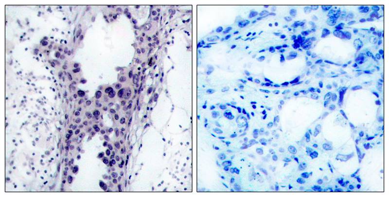 Rabbit Polyclonal Antibody to PTEN(Ab-380/382/383)