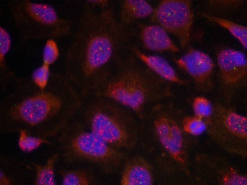 Rabbit Polyclonal Antibody to BCL-2(Ab-70)